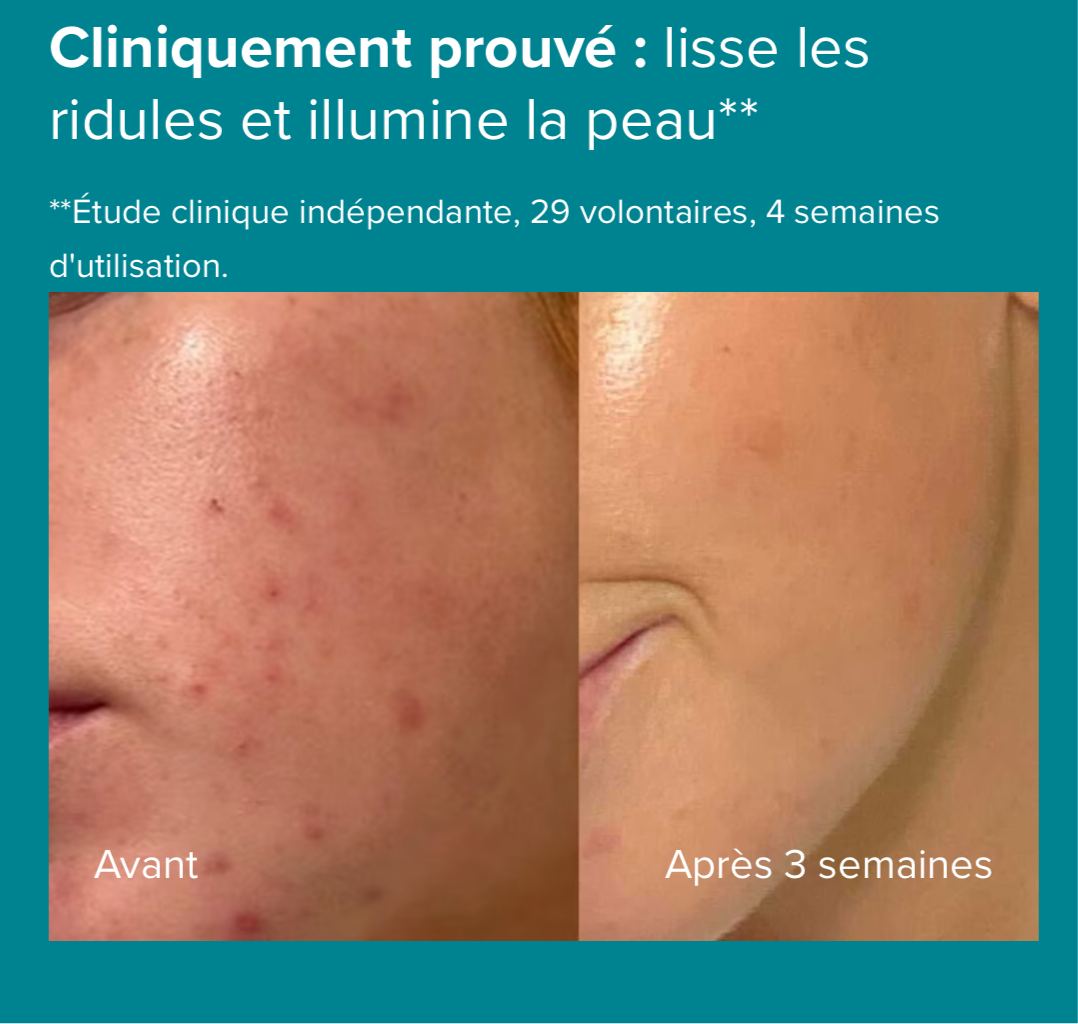 Paula’s choice Lotion Exfoliante 2 % BHA
