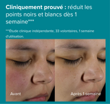 Paula’s choice Lotion Exfoliante 2 % BHA