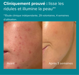 Paula’s choice Lotion Exfoliante 2 % BHA