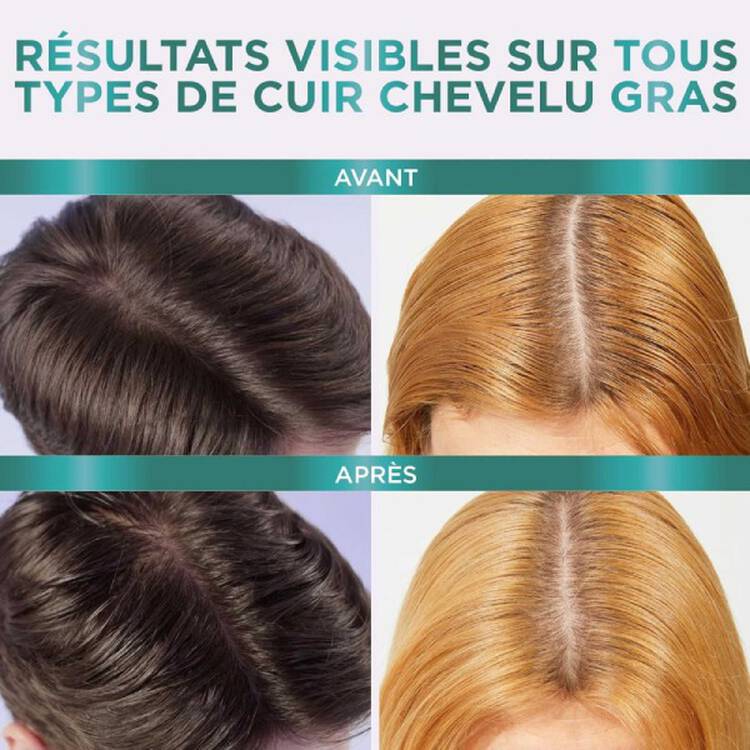 L’Oréal Paris Elseve Hyaluron Pure sérum purifiant cuir chevelu gras 102ml