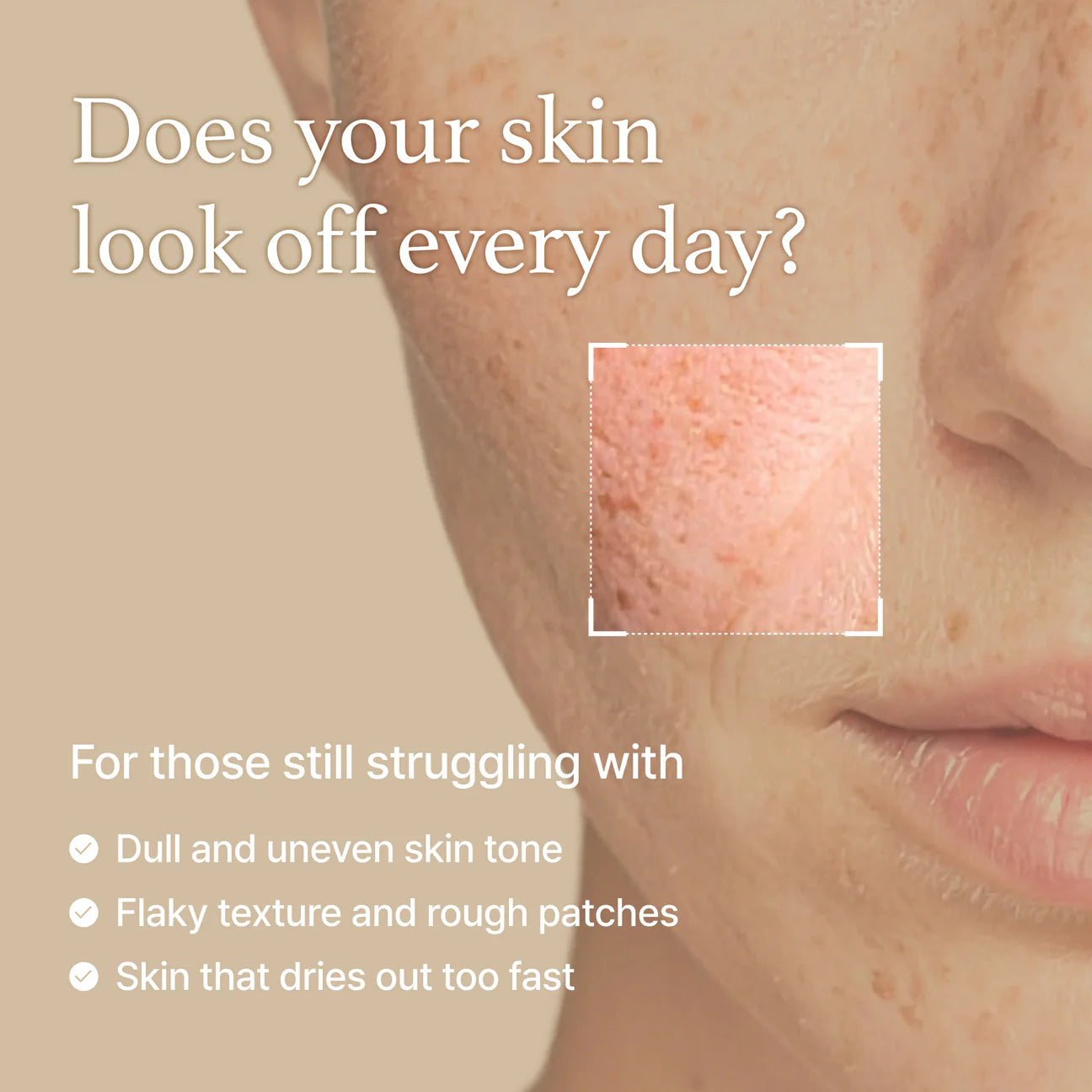 I’m from Rice Toner